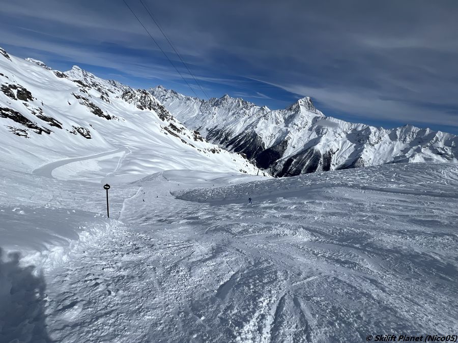 Petergsrat wird bucklig